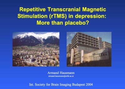 Repetitive Transcranial Magnetic Stimulation (rTMS) in depression: More than placebo?