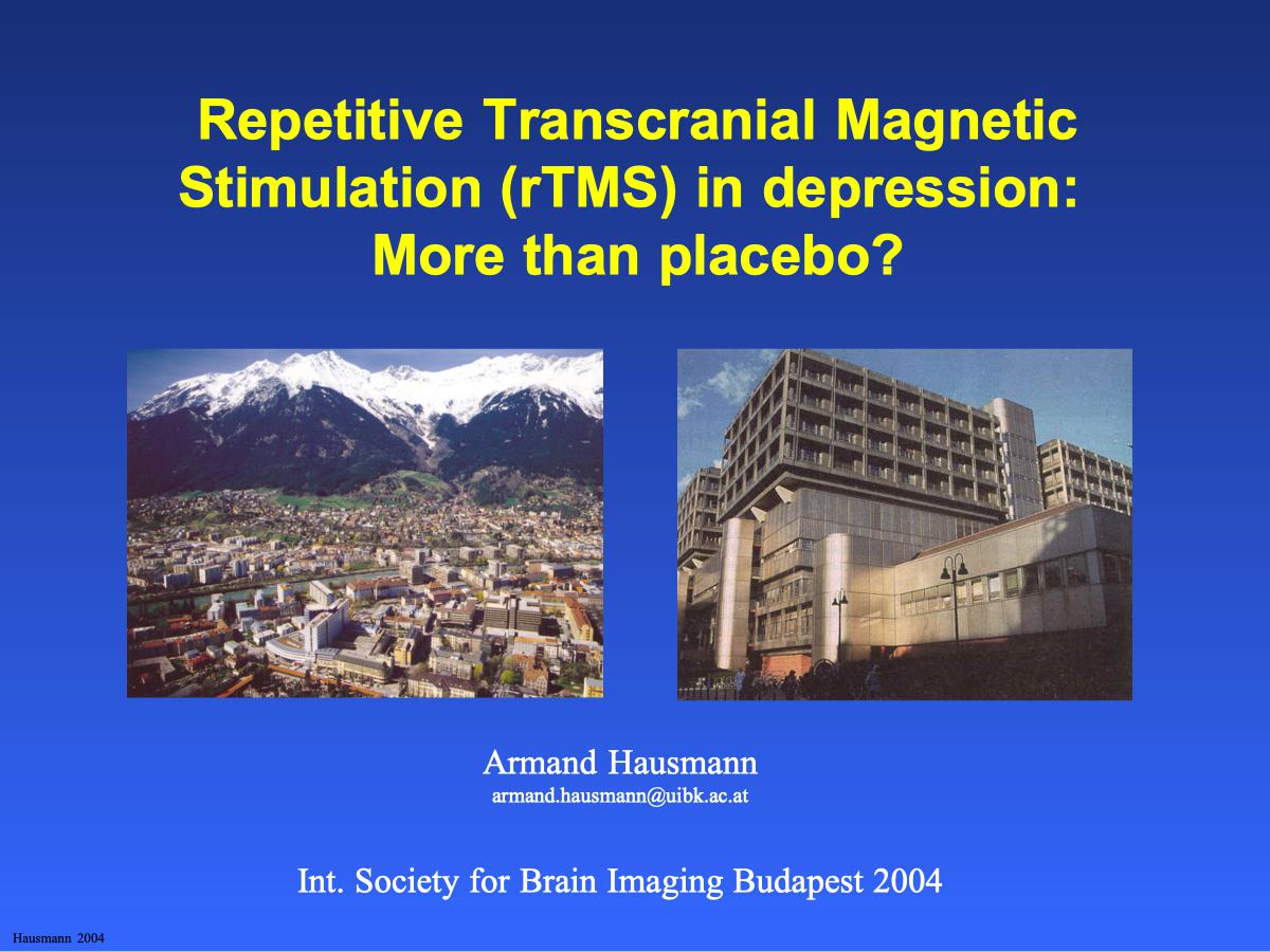 Repetitive Transcranial Magnetic Stimulation (rTMS) in depression: More than placebo? - Psychiater